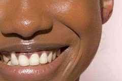 Soins du visage de sperme de beauté bizarre sont la dernière folie de la beauté Soins du visage de sperme de beauté bizarre sont la dernière folie de la beauté