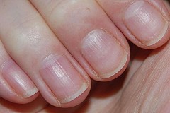 Ongles cassants
Voici comment vous pouvez traiter naturellement ce trouble
Ongles cassants
Voici comment vous pouvez traiter naturellement ce trouble