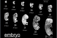 Calculatrice de grossesse

Comment connaître votre date de conception et votre date d'échéance
