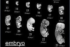 Calculatrice de grossesse

Comment connaître votre date de conception et votre date d'échéance
