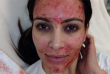 Saviez-vous que vous pouvez utiliser votre propre sang pour un soin du visage?