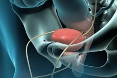 Cancer de la prostate : les pistes pour réduire les risques Cancer de la prostate : les pistes pour réduire les risques