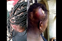 Nigeria: en colère, un homme brise la tête de sa femme avec un pilon