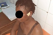 Katiola / en plein couvre-feu : Il bat à sang sa femme et s’enfuie du domicile