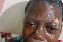 Côte d'Ivoire : Accusant sa fille d'être une sorcière, un « Pasteur » lui fait subir des violences corporelles