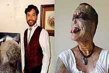 Un banquier qui a dépensé 71 000 euros pour devenir un « dragon humain » veut se faire couper le penis