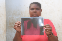 Kenya/ Fou de jalousie, un homme tente d’exciser sa femme Kenya/ Fou de jalousie, un homme tente d’exciser sa femme