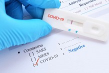 Covid-19: réduction de la validité des tests PCR à 48 h en Côte d'Ivoire