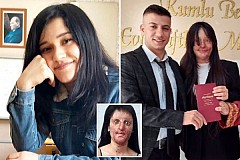 Il défigure sa petite-amie âgée de 18 ans à l’acide, elle l’épouse deux ans après Il défigure sa petite-amie âgée de 18 ans à l’acide, elle l’épouse deux ans après