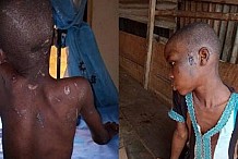 Nigeria: une fillette de 11 ans battue et nourrie de cafards par sa patronne