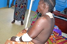 San Pedro : Pris de jalousie, un planteur taillade sa quatrième femme