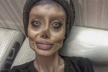 Cette jeune femme de 19 ans subit plus de 50 opérations pour ressembler à Angelina Jolie - (Photos)