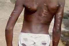 Un homme bat sa fille de ménage âgée de 10 ans et met le sel et le poivre dans ses plaies Un homme bat sa fille de ménage âgée de 10 ans et met le sel et le poivre dans ses plaies