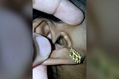 Une araignée vivante sort de son oreille (vidéo) Une araignée vivante sort de son oreille (vidéo)