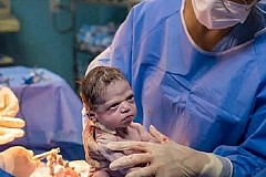 Un photographe réussit à capturer le moment où un nouveau-né fronce les sourcils devant le médecin