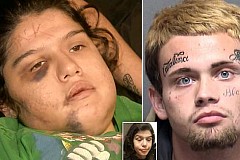 États-Unis: Il grave son nom au canif sur le front de sa copine États-Unis: Il grave son nom au canif sur le front de sa copine