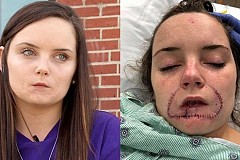 Il arrache les lèvres de son ex-compagne avec ses dents : 12 ans de prison Il arrache les lèvres de son ex-compagne avec ses dents : 12 ans de prison