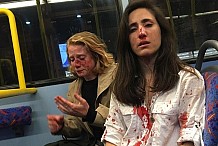 Royaume-Uni : Violente agression d'un couple lesbien dans un bus