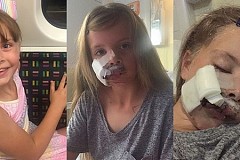 Lily, 9 ans, violemment attaquée par un Labrador : 230 points de suture