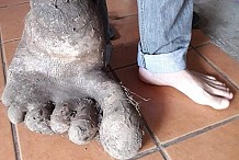 Une pomme de terre de 8 kilos en forme de pied crée le buzz au Brésil