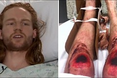 États-Unis: Il rampe pendant 10 heures pour échapper à la mort États-Unis: Il rampe pendant 10 heures pour échapper à la mort