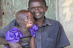 Michelle Awuor, la fillette de 8 ans qui n’arrive pas à fermer les yeux depuis 2 ans Michelle Awuor, la fillette de 8 ans qui n’arrive pas à fermer les yeux depuis 2 ans