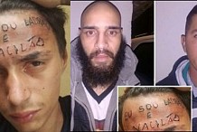 Ils tatouent de force «je suis un voleur» sur le front d'un adolescent de 17 ans
