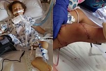 Floride : une fillette de 3 ans sauvagement attaquée par un requin

